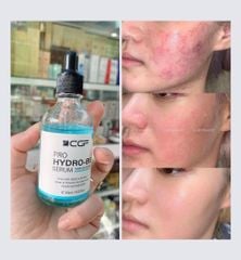 Serum phục hồi da B5 CGF