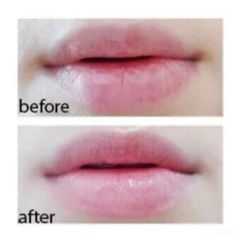 Thạch dưỡng môi đa năng Menturm