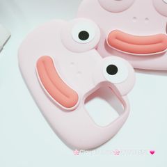 Case Ốp điện thoại iPhone Su dẻo Ếch Môi Dày 3D Nổi Xanh & Hồng iPhone 11/12/13/14/15/Pro/Promax