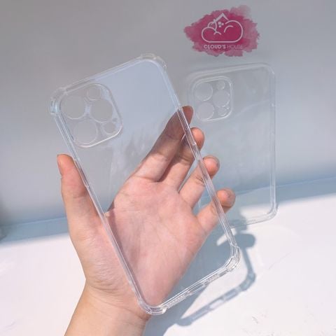 CASE DẺO TRONG SUỐT (loại trong đẹp)
