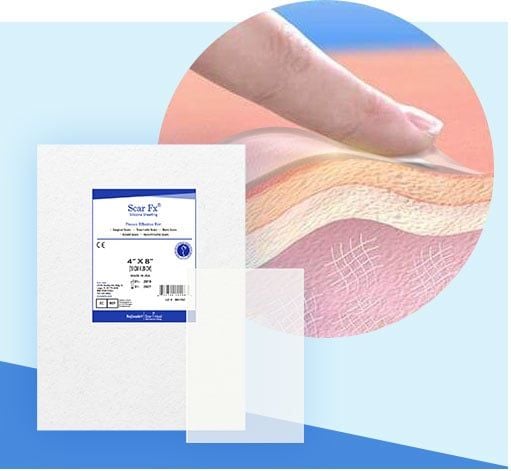  Miếng Dán Sẹo Lồi / Phì Đại REJUVASKIN Scar FX 5cm X 10cm 