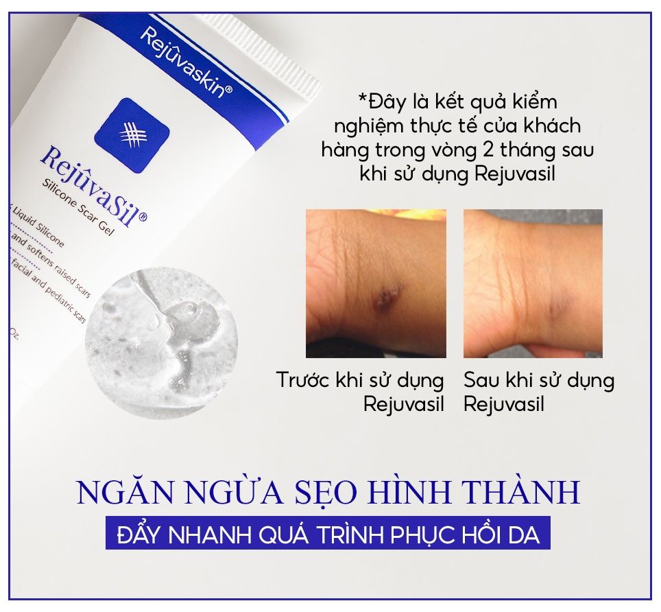  Gel ngăn ngừa sẹo, làm xẹp sẹo lồi, sẹo phì đại Rejuvasil 30ml thương hiệu Rejuvaskin 