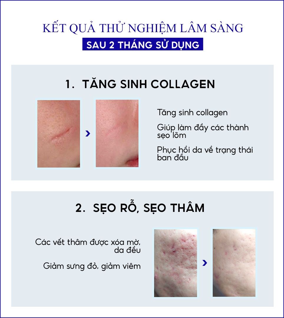  Kem xóa Sẹo Thâm, lấp đầy Sẹo Rỗ, Sẹo Lõm Scar Esthetique 30ml của Rejuvaskin 