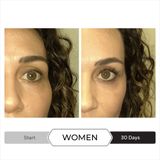  Serum dưỡng lông mi cao cấp SPECTRAL.LASH 2,4ML 