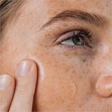  Serum trị sẹo thâm, mờ nám, xoá tàn nhang Advanced dark spot corrector 30ML 