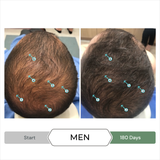  Serum giảm gãy, rụng, giảm gàu, kích thích mọc tóc SPECTRAL.CBD 60ml 