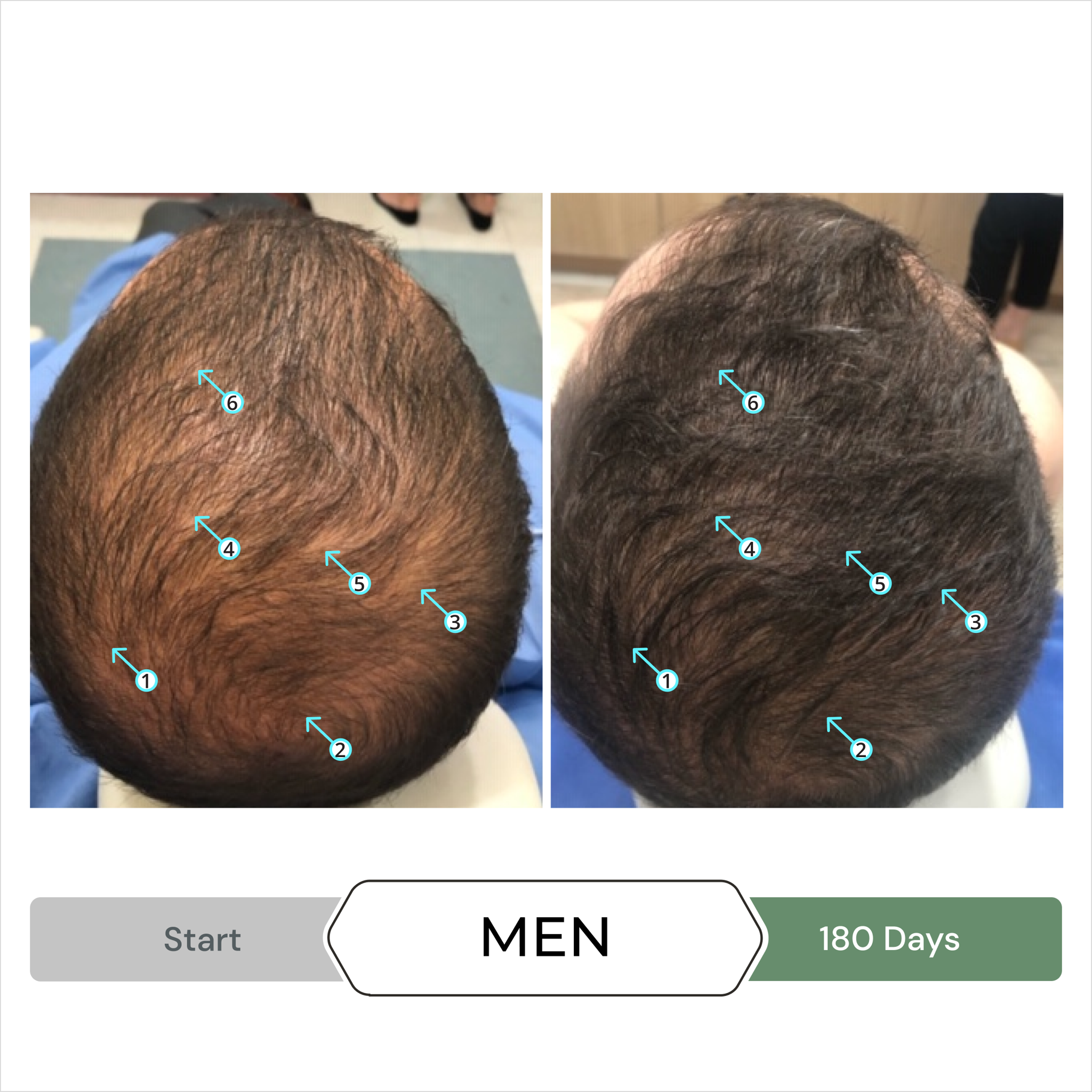  Serum giảm gãy, rụng, giảm gàu, kích thích mọc tóc SPECTRAL.CBD 60ml 