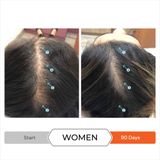  Viên hỗ trợ mọc tóc, kiểm soát rụng tóc REVITA 30 TABLETS 