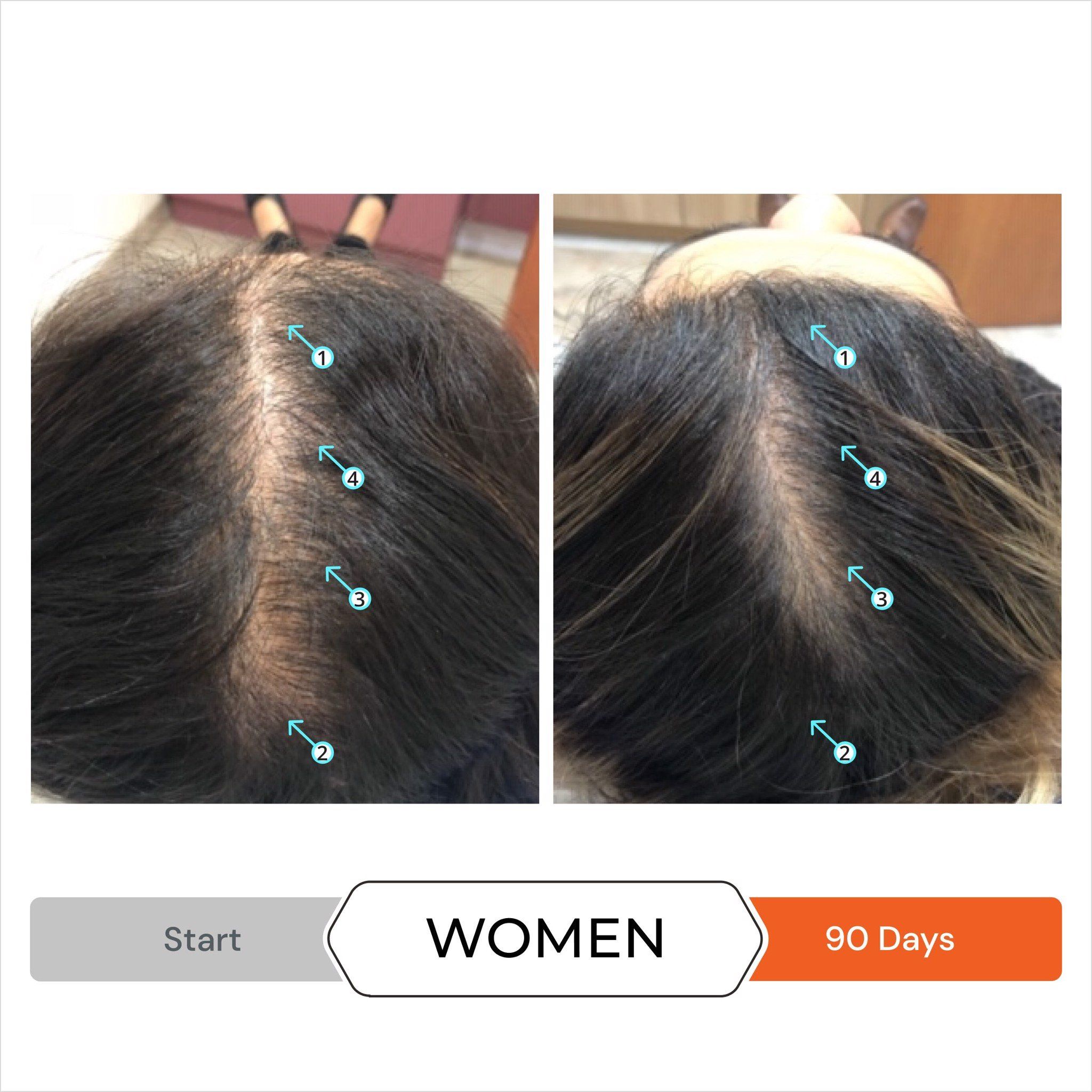  Viên hỗ trợ mọc tóc, kiểm soát rụng tóc REVITA 30 TABLETS 