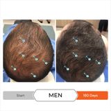  Viên hỗ trợ mọc tóc, kiểm soát rụng tóc REVITA 30 TABLETS 