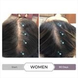  Serum kích thích mọc tóc, giảm tóc gãy rụng cho nữ SPECTRAL.CSF 60ml (for Women) 