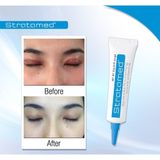  Gel liền vết thương hở sau phẫu thuật, ngăn ngừa sẹo Stratamed Thuỵ Sĩ 