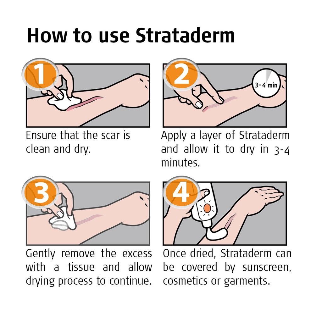  Gel xoá mờ sẹo thâm, rỗ, lõm Strataderm 20g Thuỵ Sĩ 