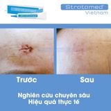  Gel phục hồi vết thương hở sau phẫu thuật, ngăn ngừa sẹo thâm, sẹo rỗ, sẹo lõm, sẹo phì đại Stratamed 10G Thuỵ Sĩ 