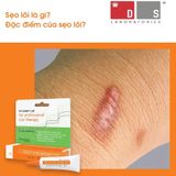  Gel xoá mờ sẹo thâm, rỗ, lõm Strataderm 20g Thuỵ Sĩ 