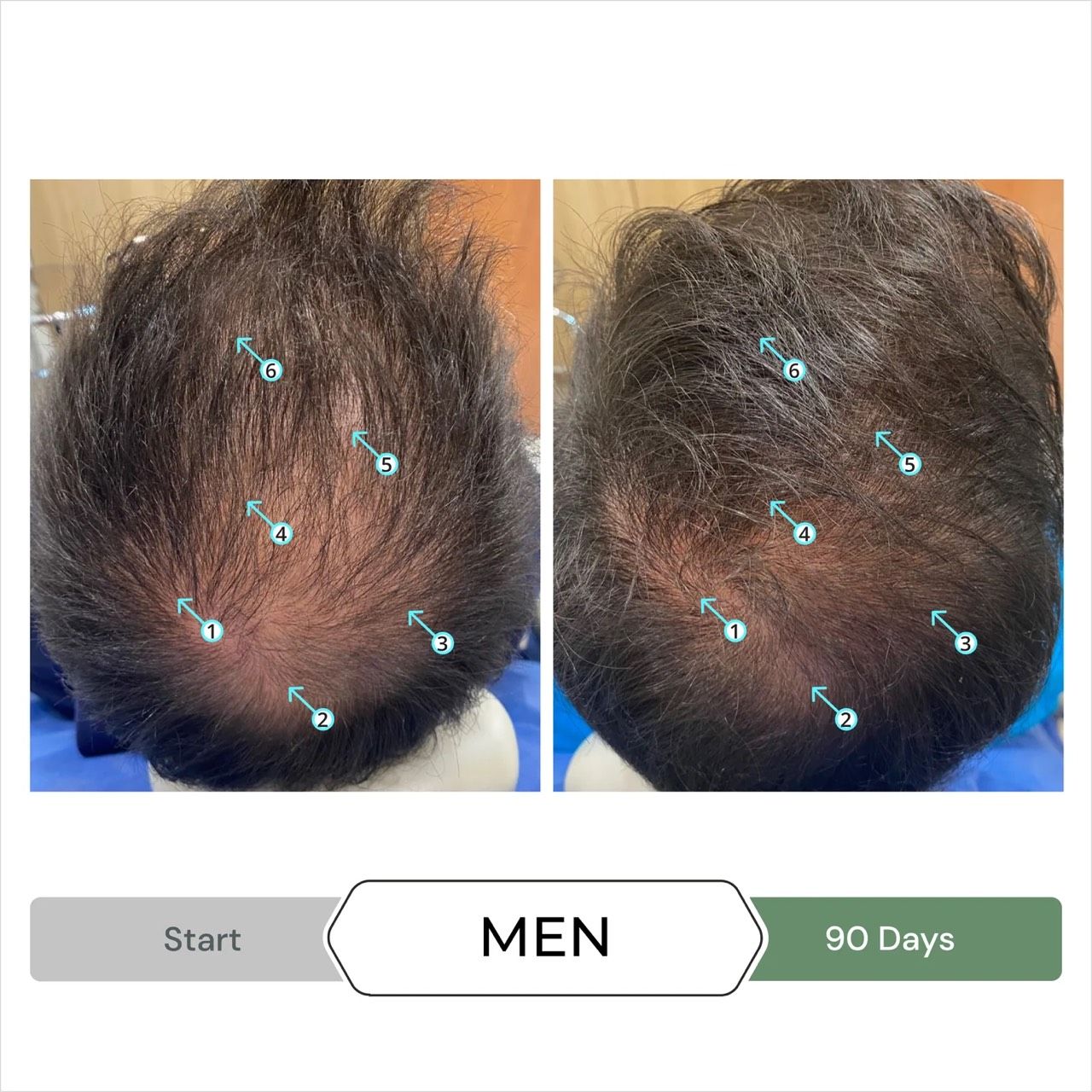  Dầu gội kích thích mọc tóc chống oxy hoá REVITA®.CBD super antioxidant hair stimulating shampoo  205ml 