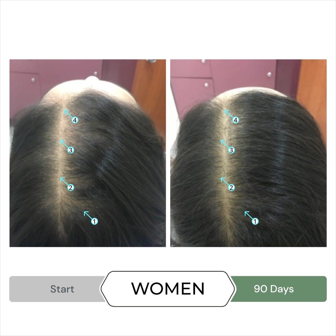  Dầu xả kích thích mọc tóc chống oxy hoá REVITA®.CBD super antioxidant hair stimulating conditioner  205ml 