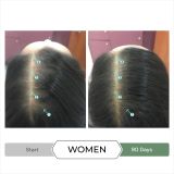  Dầu xả kích thích mọc tóc chống oxy hoá REVITA®.CBD super antioxidant hair stimulating conditioner  205ml 