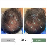  Dầu xả kích thích mọc tóc chống oxy hoá REVITA®.CBD super antioxidant hair stimulating conditioner  205ml 