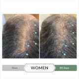  Dầu xả kích thích mọc tóc chống oxy hoá REVITA®.CBD super antioxidant hair stimulating conditioner  205ml 