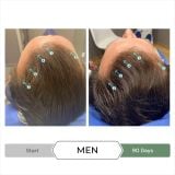  Dầu xả kích thích mọc tóc chống oxy hoá REVITA®.CBD super antioxidant hair stimulating conditioner  205ml 