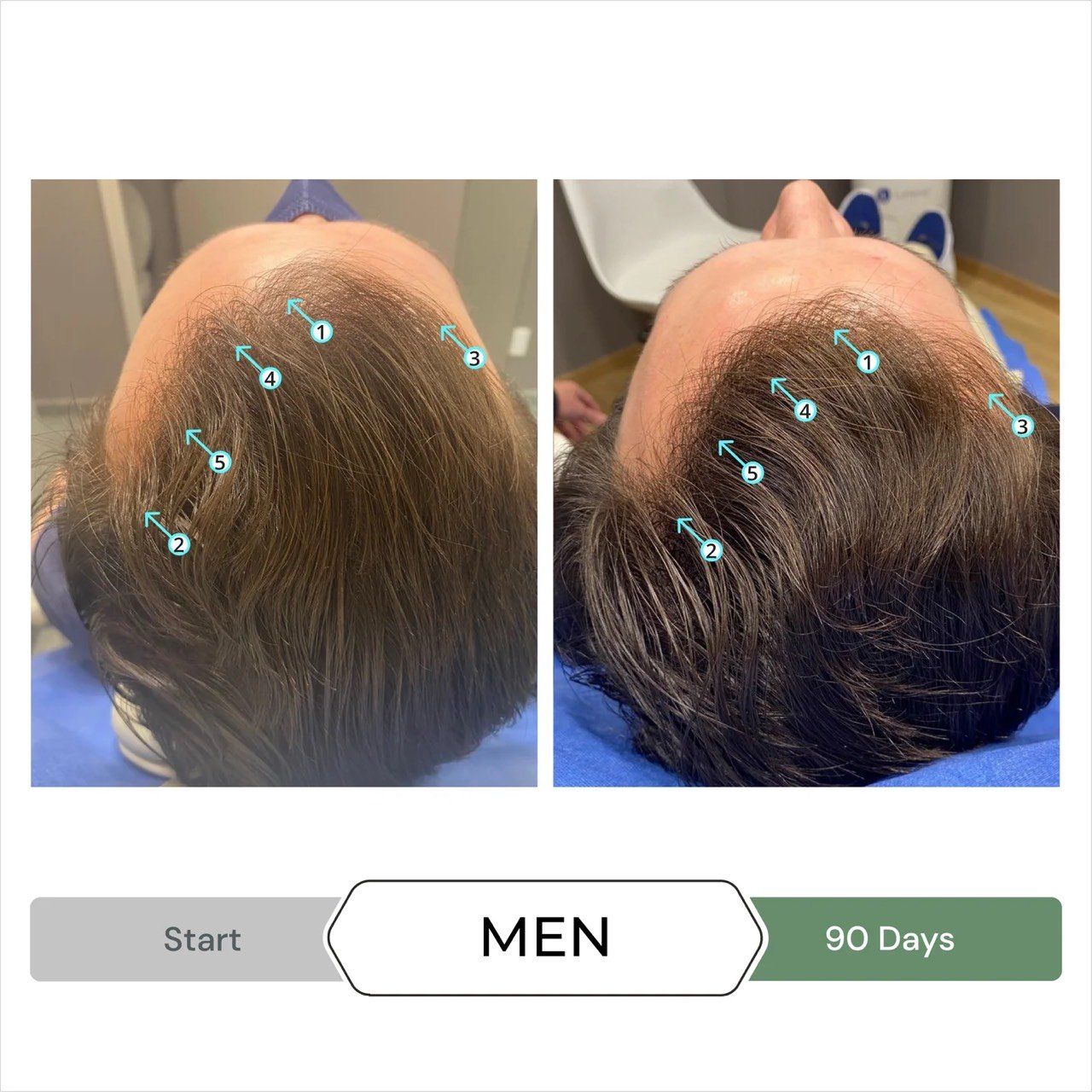  Dầu xả kích thích mọc tóc chống oxy hoá REVITA®.CBD super antioxidant hair stimulating conditioner  205ml 