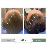  Dầu xả kích thích mọc tóc chống oxy hoá REVITA®.CBD super antioxidant hair stimulating conditioner  205ml 