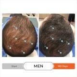  Kẹo kích thích mọc tóc, tăng trưởng tóc REVITA GUMMIES 