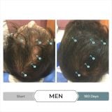  Viên hỗ trợ mọc tóc, giảm Stress, chống oxy hóa REVITA.SOD 30 TABLETS 