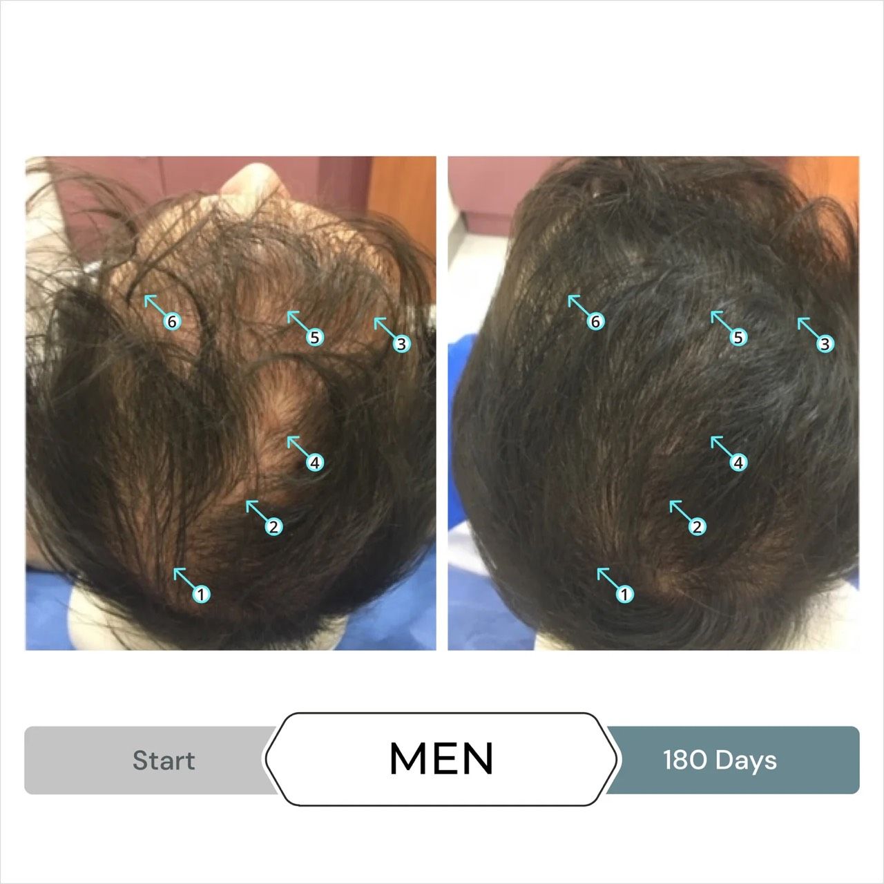  Viên hỗ trợ mọc tóc, giảm Stress, chống oxy hóa REVITA.SOD 30 TABLETS 