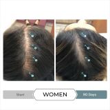  Viên hỗ trợ mọc tóc, giảm Stress, chống oxy hóa REVITA.SOD 30 TABLETS 