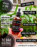  Serum Hitopla Tế Bào Gốc Nhau Thai Phục Hồi Da Ngừa Nám Tàn Nhang 60ml 