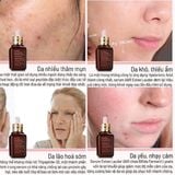  Serum Dưỡng Da Estee Lauder Advanced Night Repair 