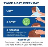  Gel Mọc Tóc Nam Giới Men's Rogaine Extra Strength 