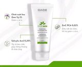 Sữa Rửa Mặt Babe Stop AKN Purifying Cleaning Gel Cho Da Dầu Mụn 