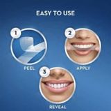  Set Dán Trắng Răng Crest 3D White Whitestrips Dental Whitening Kit 