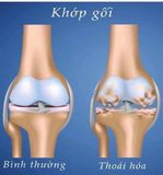  Viên Uống Tái Tạo Sụn Khớp COSAMIN DS JOINT Health 210 Viên 