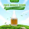  Serum ngăn ngừa mụn, dưỡng trắng da Stt White 7 Days Miracle Serum 20ml 
