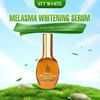  SERUM DƯỠNG TRẮNG MELASMA WHITENING SERUM STT WHITE 40ML 