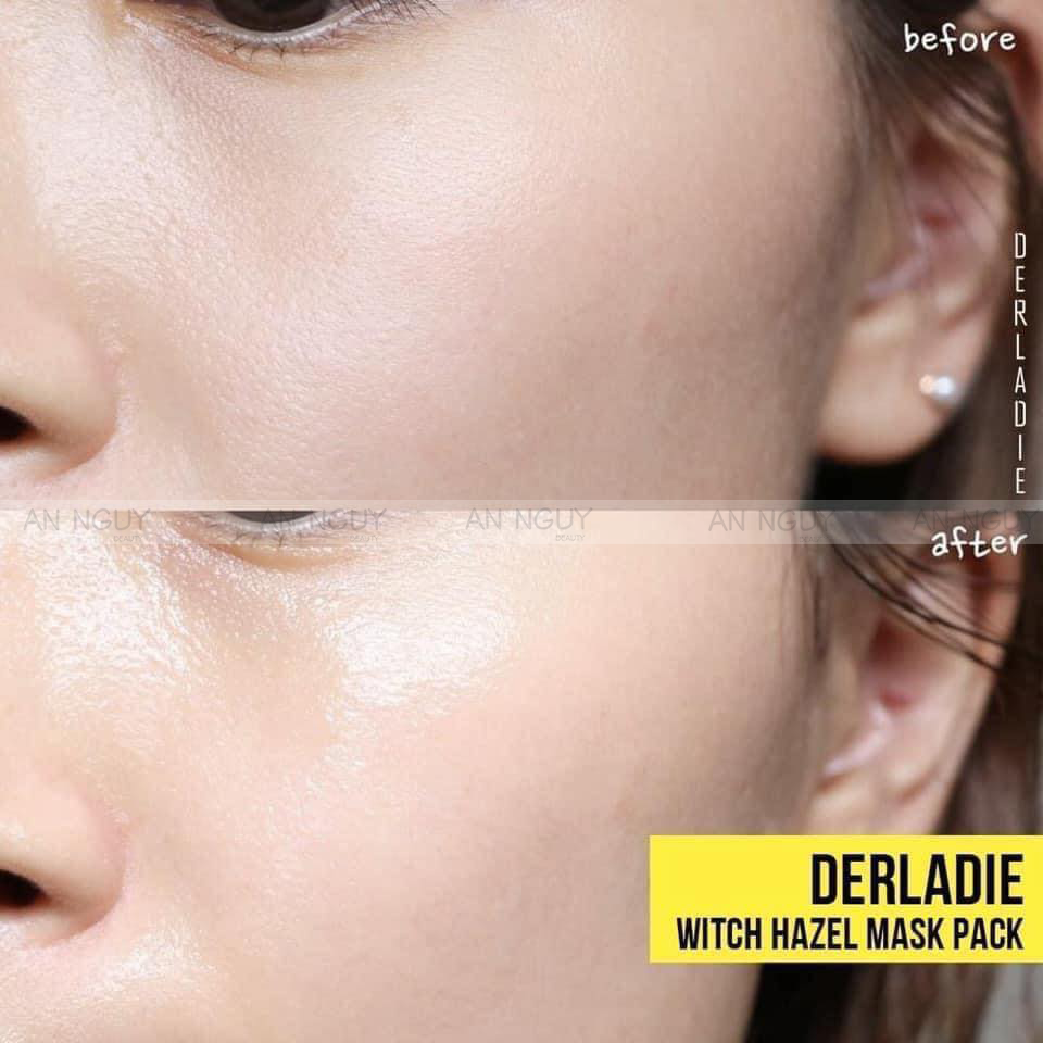 Mặt Nạ Derladie Witch Hazel Mask Pack Giảm Sưng Viêm 30ml