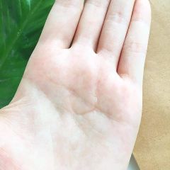 Nước Hoa Hồng Tràm Trà Naruko Tea Tree Shine Control & Blemish Clear Toner Giảm Mụn, Kháng Viêm 150ml