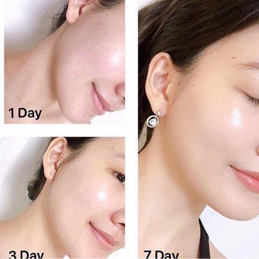 Kem Dưỡng Olay Total Effects 7 in One Night Firming Moisturiser Dưỡng Ẩm,  Ngăn Lão Hóa Da 50mlKem Dưỡng Olay Total Effects 7 in One Night Firming Moisturiser  50ml – annguy.beauty