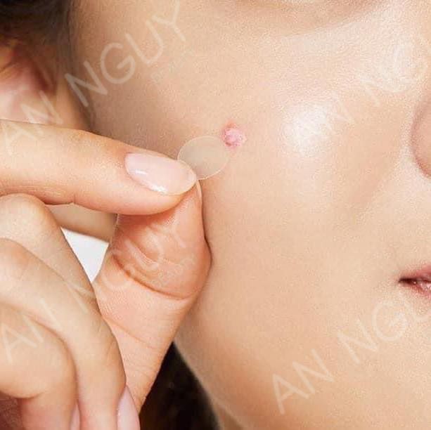 Miếng Dán Mụn Cosrx Acne Pimple Master Patch Se Cồi Mụn, Ngăn Hình Thành Sẹo 3 Size 24 Miếng