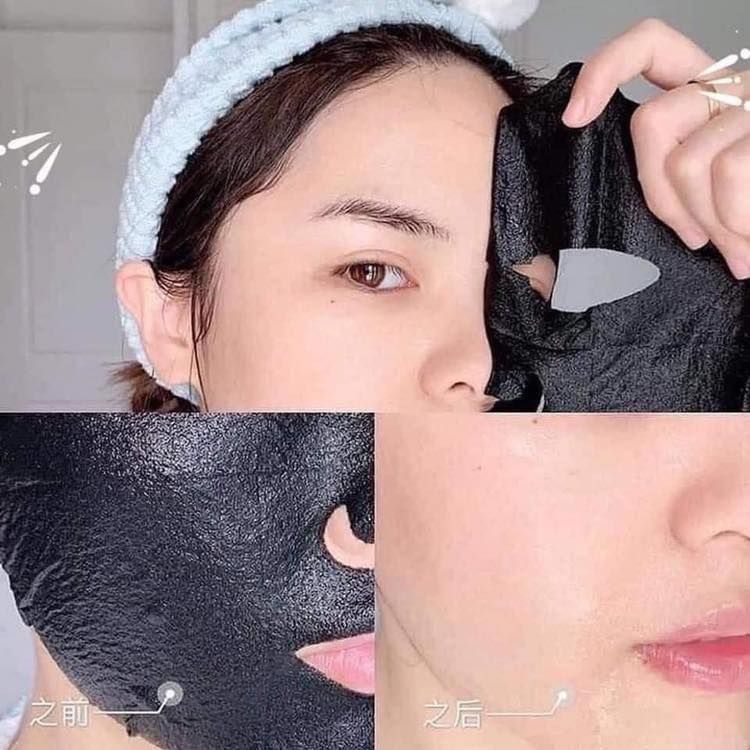 Mặt Nạ Dưỡng Da Naruko Mask Chăm Sóc Mọi Loại Da