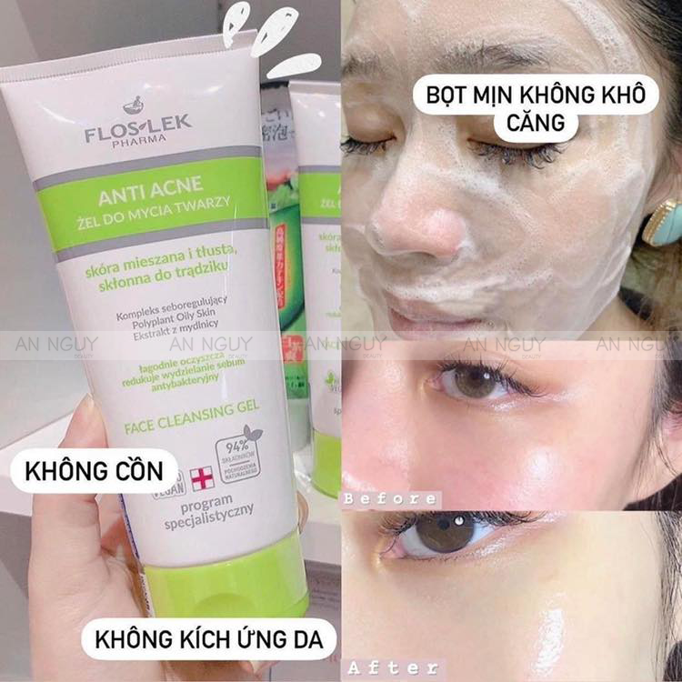 Sữa Rửa Mặt Floslek Anti Acne Face Cleansing Gel Dành Cho Da Dầu Mụn 200ml
