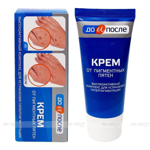 Kem Dưỡng Mờ Nám Tay Kpem Twins Tec Dưỡng Da Tay Mịn Màng 50ml