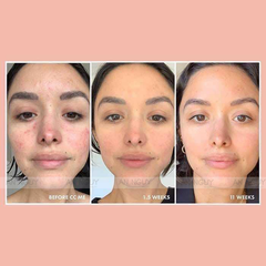 Kem Dưỡng Olay Vitamin C+Peptide 24 Giúp Sáng Da 48g