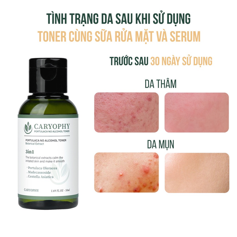 Nước Hoa Hồng Caryophy No Alcohol Toner Không Cồn Dành Cho Mọi Loại Da 50ml