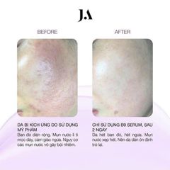 Tinh Chất Juliette Armand Folic Acid B9 Serum Chống Kích Ứng 20ml