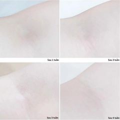 Kem Ngăn Mùi Dove Deodorant Dry Serum 3% Niacinamide Dưỡng Sáng, Đều Màu 40ml